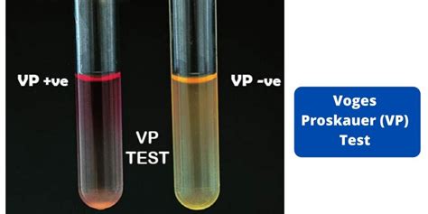 Voges Proskauer (VP) Test: Principle, Procedure, Results.